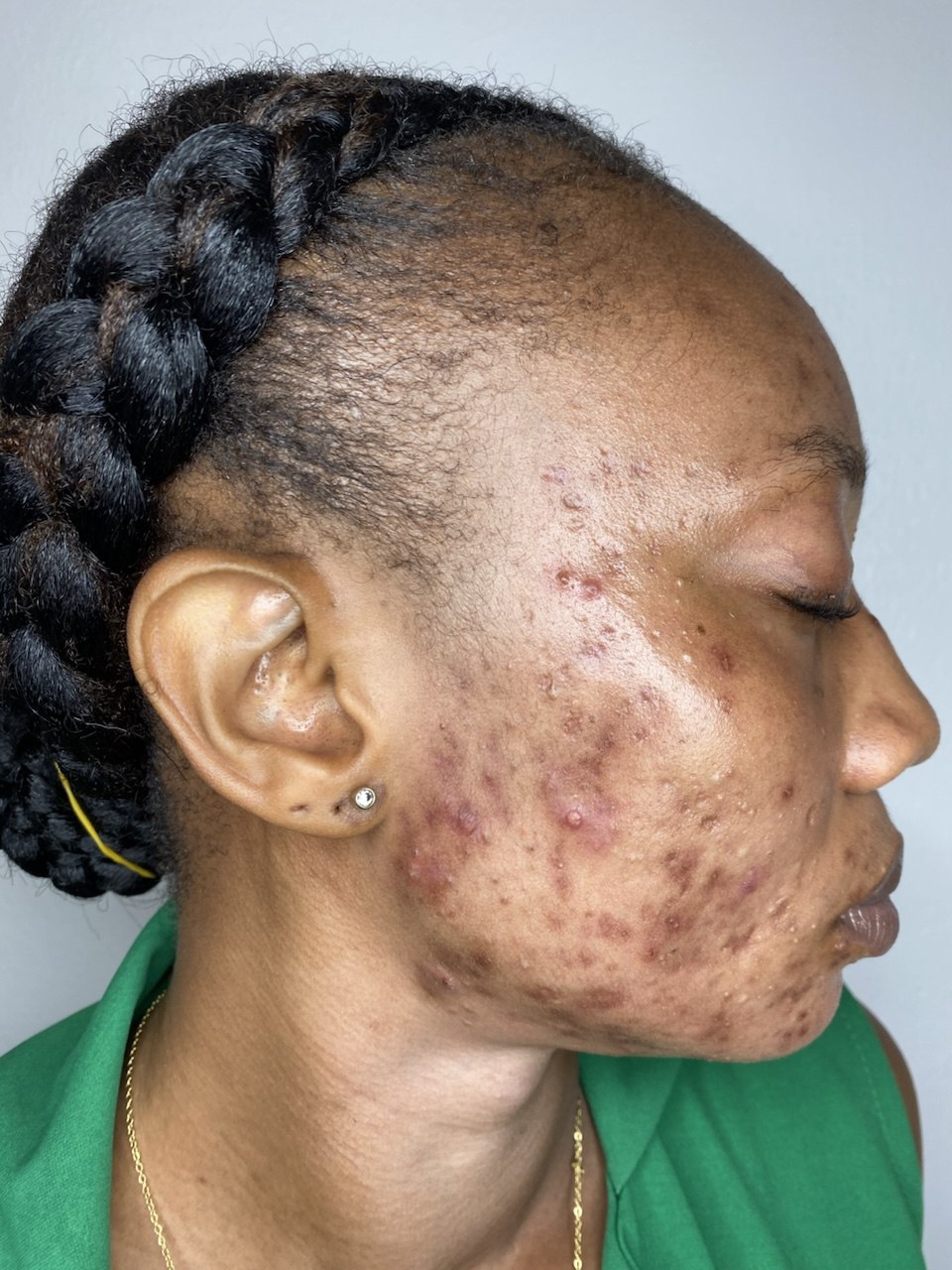 Treatment Case 05 before