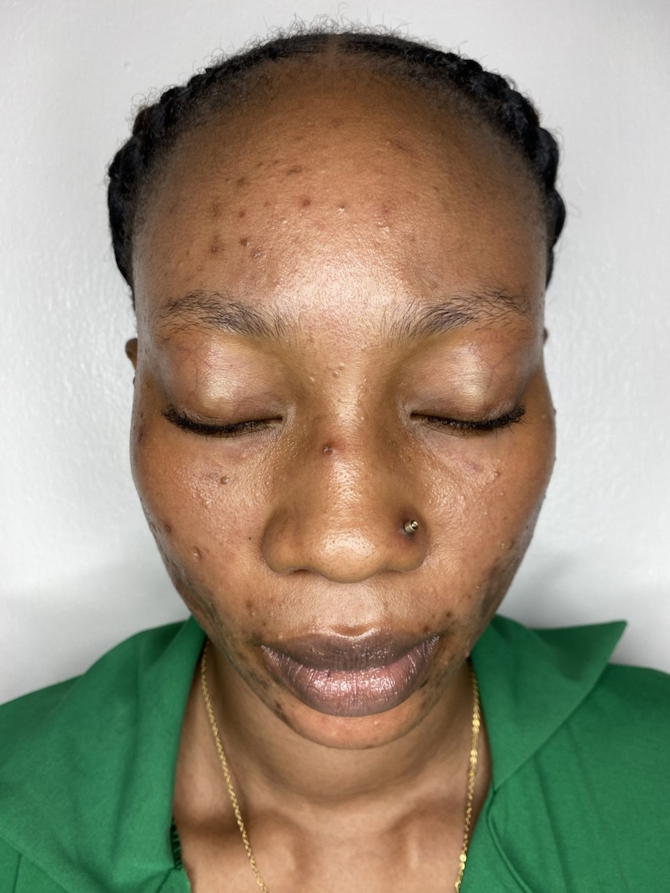 Treatment Case 06 before