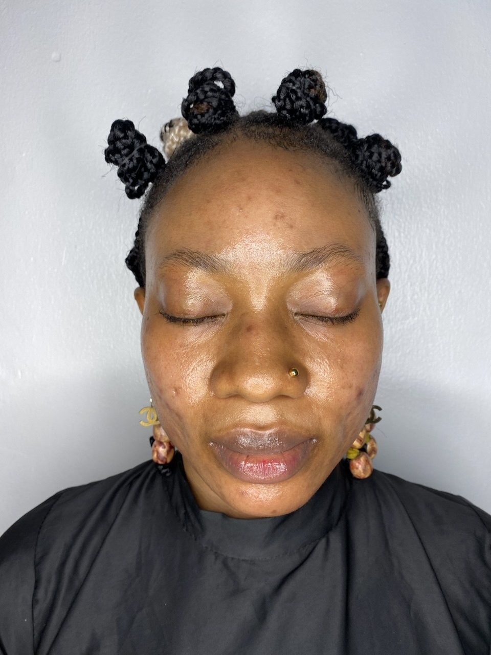 Treatment Case 06 after