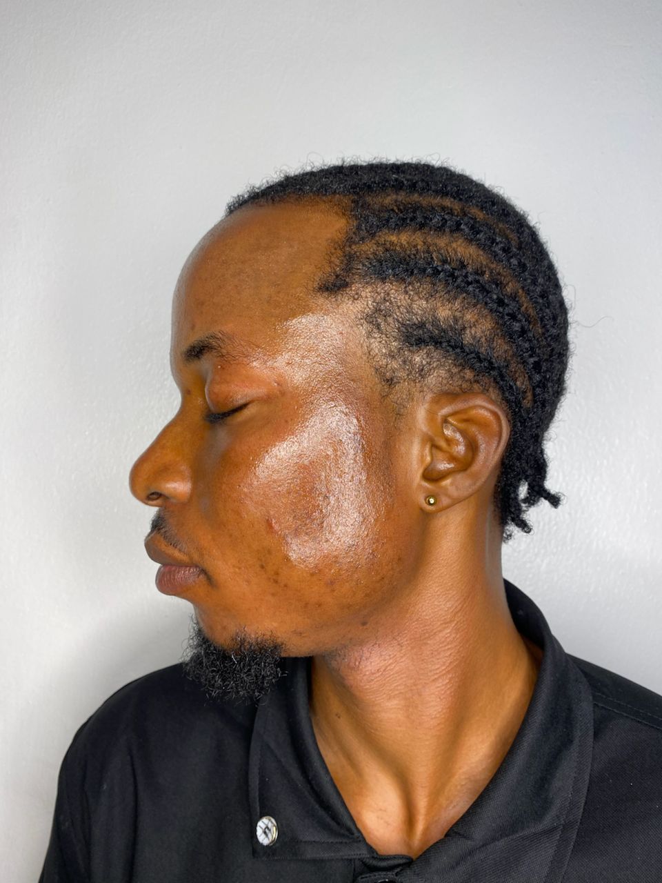 Pigmentation Balance after